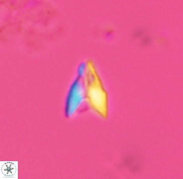 Ceratolithoides sagittatus 3338