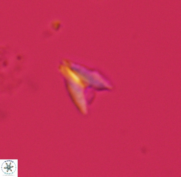 Ceratolithoides sagittatus 3339