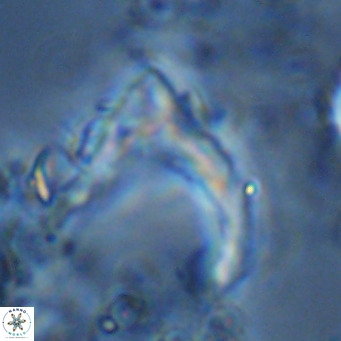 Ceratolithus cf armatus VR 08750