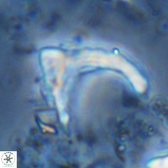 Ceratolithus cf armatus VR 08752