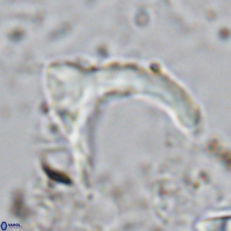 Ceratolithus cf armatus VR 08753