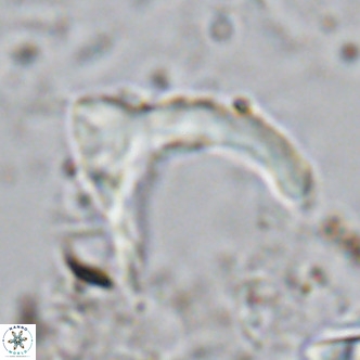 Ceratolithus cf armatus VR 08753