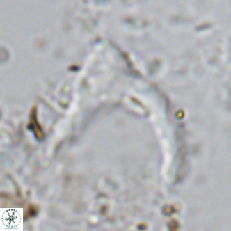 Ceratolithus cf armatus VR 08754