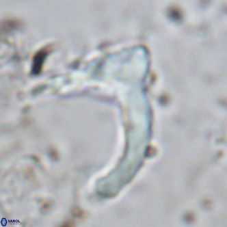 Ceratolithus cf armatus VR 08755