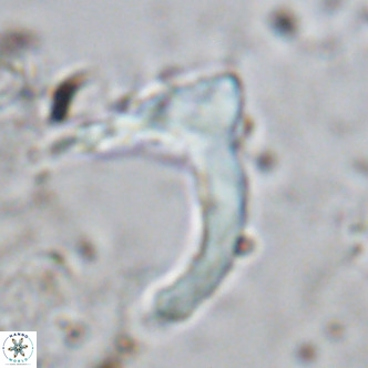 Ceratolithus cf armatus VR 08755