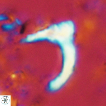 Ceratolithus cf armatus VR 08756
