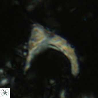 Ceratolithus cf armatus VR 08758