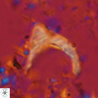 Ceratolithus cf armatus VR 08759
