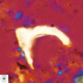 Ceratolithus cf armatus VR 08762