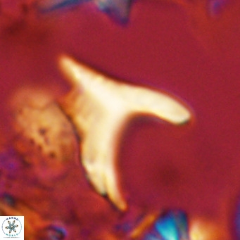 Ceratolithus apiculus VR 07974