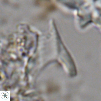 Ceratolithus apiculus VR 07977