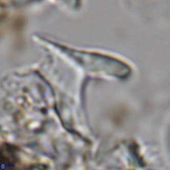 Ceratolithus apiculus VR 07979