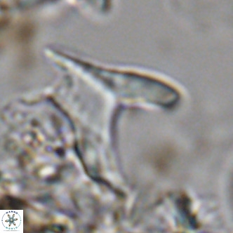 Ceratolithus apiculus VR 07979