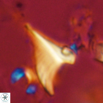 Ceratolithus apiculus VR 08226