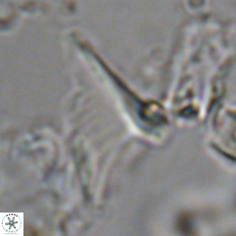Ceratolithus apiculus VR 08233