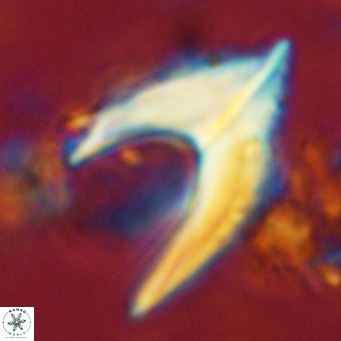 Ceratolithus armatus VR 08074