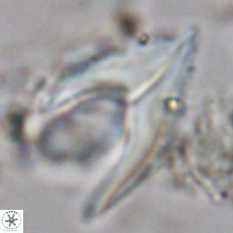 Ceratolithus armatus VR 08075
