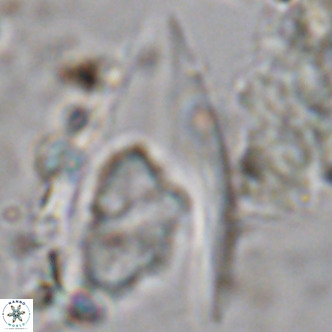 Ceratolithus armatus VR 08076