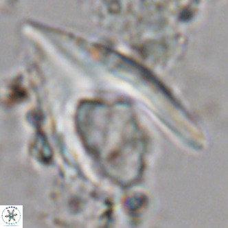 Ceratolithus armatus VR 08077