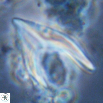 Ceratolithus armatus VR 08079