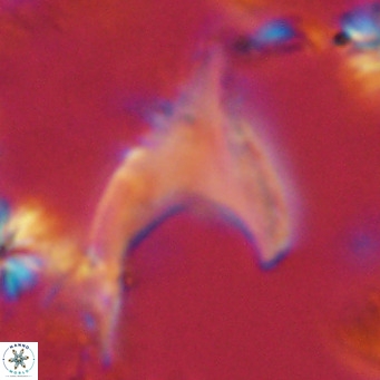 Ceratolithus armatus VR 08355