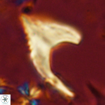 Ceratolithus armatus VR 08356