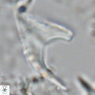 Ceratolithus armatus VR 08358