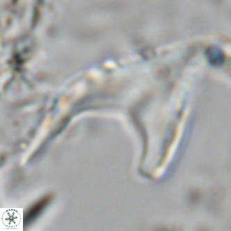 Ceratolithus armatus VR 08360