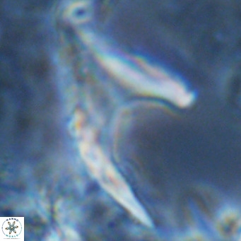 Ceratolithus armatus VR 08363