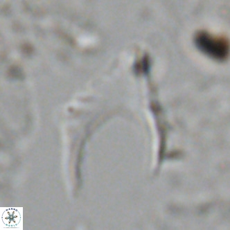 Ceratolithus armatus VR 08395