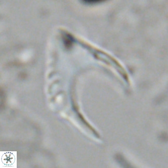 Ceratolithus armatus VR 08397