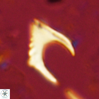 Ceratolithus armatus VR 08398