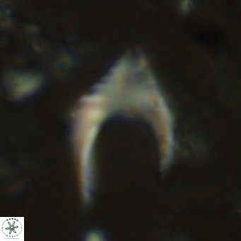Ceratolithus armatus VR 08400