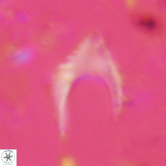 Ceratolithus armatus VR 08401