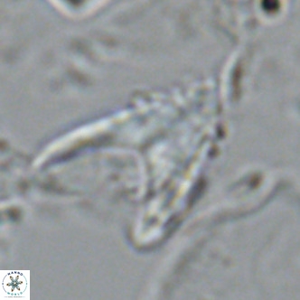 Ceratolithus armatus VR 08740