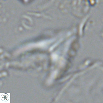 Ceratolithus armatus VR 08741