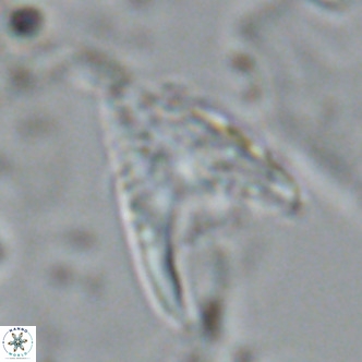 Ceratolithus armatus VR 08744