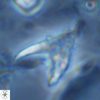 Ceratolithus armatus VR 08748