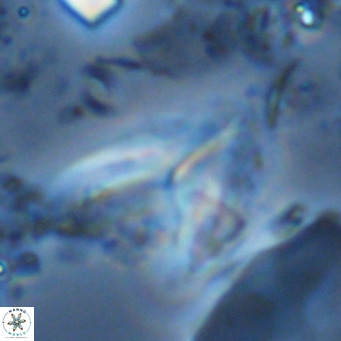 Ceratolithus armatus VR 08749