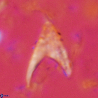 Ceratolithus armatus VR 08730