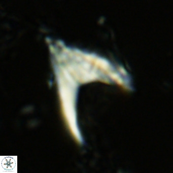 Ceratolithus armatus VR 08732