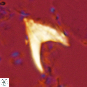 Ceratolithus armatus VR 08733
