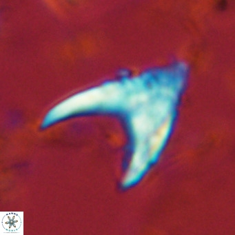 Ceratolithus armatus VR 08738