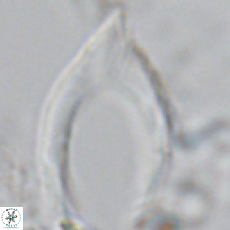 Ceratolithus armatus VR 09214