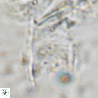 Ceratolithus atlanticus 43439