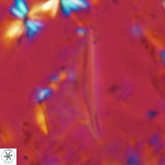 Ceratolithus dontia VR 07147