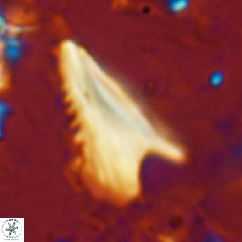 Ceratolithus dontia VR 07148