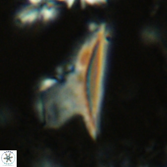 Ceratolithus dontia VR 07143