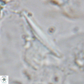 Ceratolithus dontia VR 07154