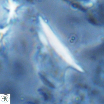Ceratolithus dontia VR 07155